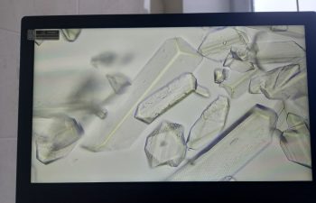 соли в моче животного под микроскопом